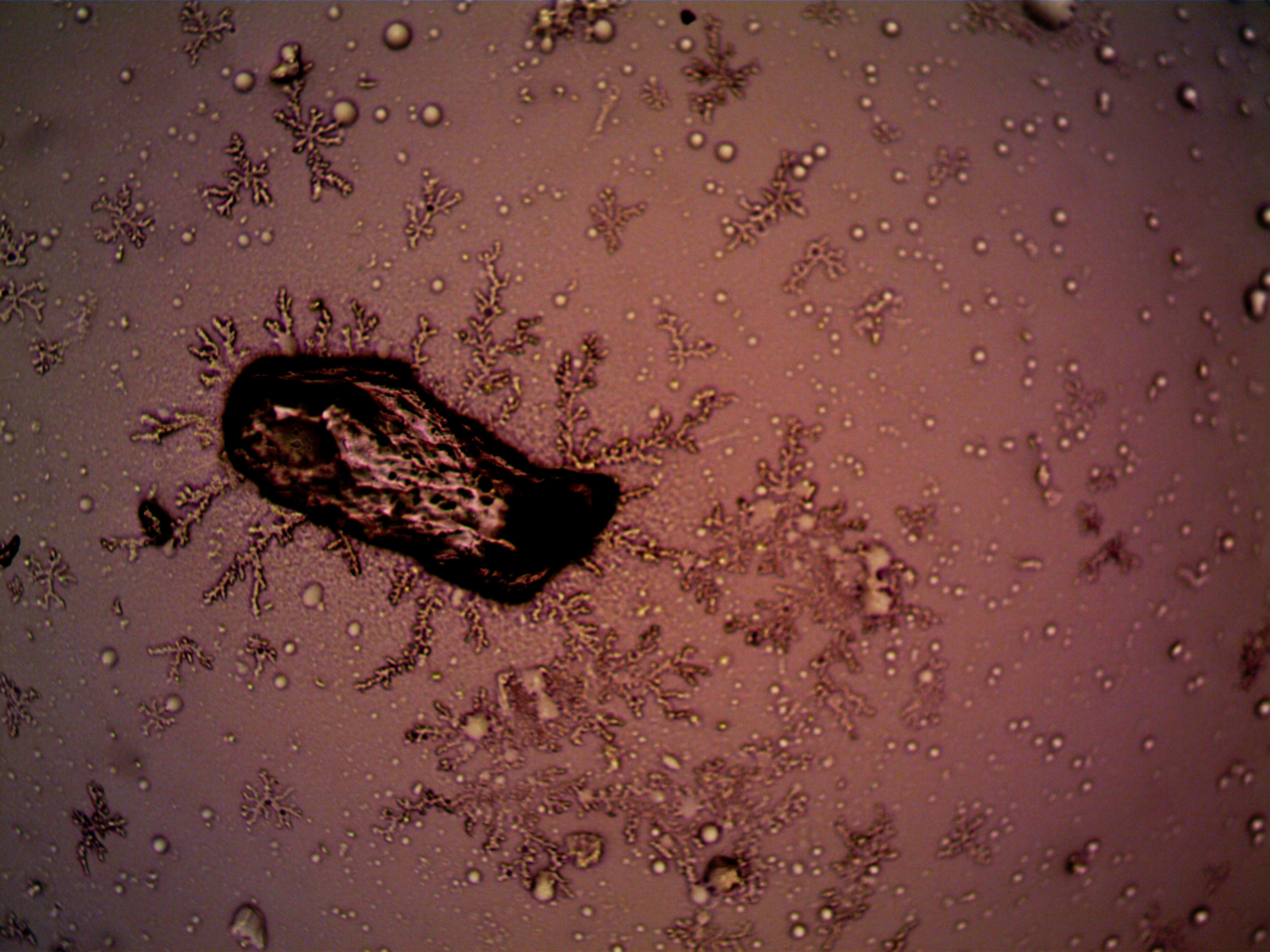 Vibrio Vulnificus in Louisiana: Symptoms, Risks, and Prevention