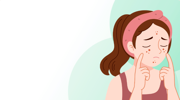 Skin & Acne Problems illustration